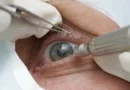 Cirurgia que altera cor do olho tem uso restrito para pessoas cegas