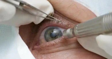 Cirurgia que altera cor do olho tem uso restrito para pessoas cegas