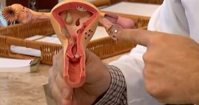 Edital do CNPq vai financiar pesquisas sobre endometriose