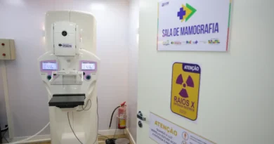 Brasília (DF) 23/10/2025 - Equipamento de mamografia da carreta de saúde da mulher do programa Agora Tem Especialistas no estacionamento do Hospital Regional de Ceilândia, cidade satélite de Brasília Foto: Fabio Rodrigues-Pozzebom/ Agência Brasil
