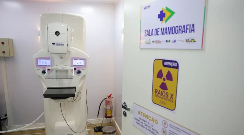 Brasília (DF) 23/10/2025 - Equipamento de mamografia da carreta de saúde da mulher do programa Agora Tem Especialistas no estacionamento do Hospital Regional de Ceilândia, cidade satélite de Brasília Foto: Fabio Rodrigues-Pozzebom/ Agência Brasil