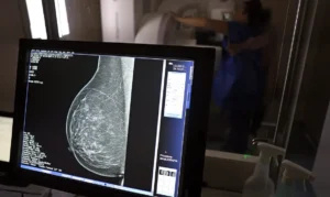 Brasília (DF), 01/10/2024 - Teste de mamografia realizado na Campanha Outubro Rosa: Sesc-DF, que oferece exames e consultas gratuitas às mulheres. Foto: José Cruz/Agência Brasil