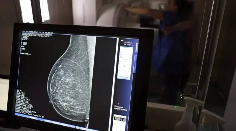 Brasília (DF), 01/10/2024 - Teste de mamografia realizado na Campanha Outubro Rosa: Sesc-DF, que oferece exames e consultas gratuitas às mulheres. Foto: José Cruz/Agência Brasil